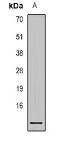 S100-A1 Rabbit Polyclonal Antibody