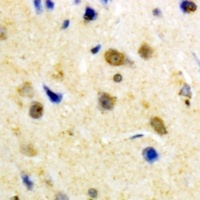Anti-S100-A1 Antibody