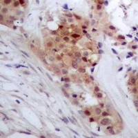 TP53INP2 antibody