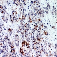 Anti-BATF3 Antibody