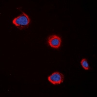 Anti-CHRM5 Antibody