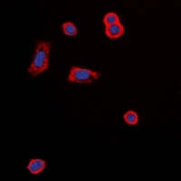 Anti-MC5 Receptor Antibody