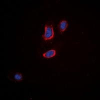 Anti-Tachykinin Receptor 3 Antibody