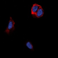 Anti-TRB1 Antibody