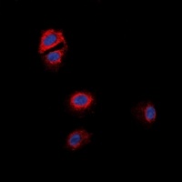 Anti-GPR170 Antibody