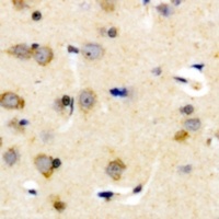 Anti-Plasma Kallikrein HC Antibody
