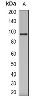 VAV1 Rabbit Polyclonal Antibody