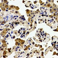 Anti-ZAP70 Antibody