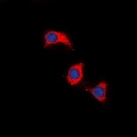 Anti-ZAP70 Antibody