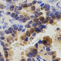 Anti-ZAP70 Antibody