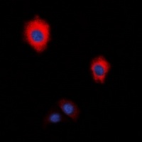 Anti-ZAP70 Antibody