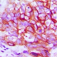 EGFR (Phospho-Y1197) Antibody