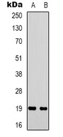 STMN1 Antibody