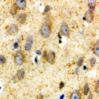 Anti-GLUR1 Antibody