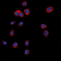 Anti-GLUR1 Antibody