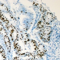 HNF4 alpha Antibody