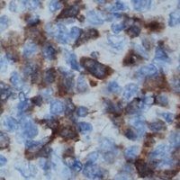 IL-16 antibody
