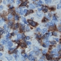Anti-IL-16 Antibody