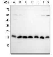 EIF5A2 Rabbit Polyclonal Antibody