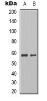 Pyruvate Kinase Rabbit Polyclonal Antibody