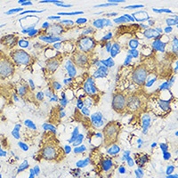 Anti-ATF6 Antibody