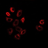 Anti-ATF6 Antibody