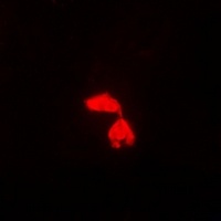 Anti-PA28 gamma Antibody