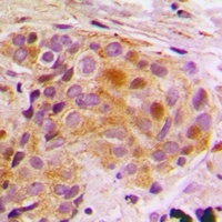 Anti-STAT5B Antibody