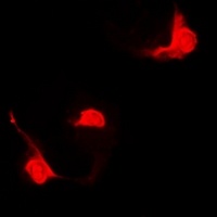 Anti-STAT5B Antibody