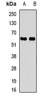 CARD 8 Rabbit Polyclonal Antibody