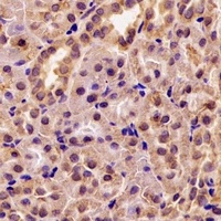 Anti-GRP75 Antibody