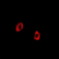 Anti-GRP75 Antibody