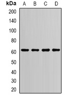 PDI Rabbit Polyclonal Antibody