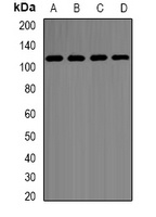 Hexokinase 2 Rabbit Polyclonal Antibody