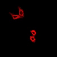 Anti-Hexokinase 2 Antibody
