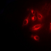 Anti-TPMT Antibody