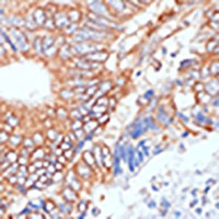 ENO1 antibody