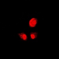 PSMB1 antibody