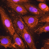 Anti-PSMD4 Antibody