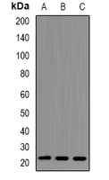 RhoC Antibody