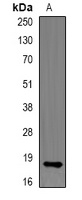 RNase 13 Rabbit Polyclonal Antibody