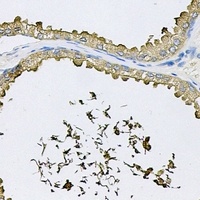 Anti-RNase 13 Antibody