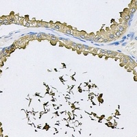 RNASE13 antibody