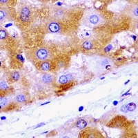 HADH antibody