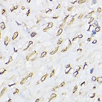 Anti-Emerin Antibody