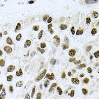 Anti-CTCF Antibody