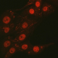 Anti-CTCF Antibody
