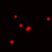 Fibrillarin Antibody
