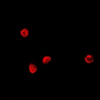 Anti-TCF4 Antibody