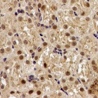Anti-EGLN1 Antibody